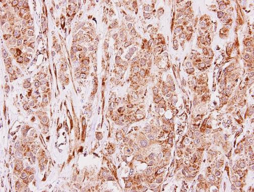 MMP19 Antibody in Immunohistochemistry (Paraffin) (IHC (P))