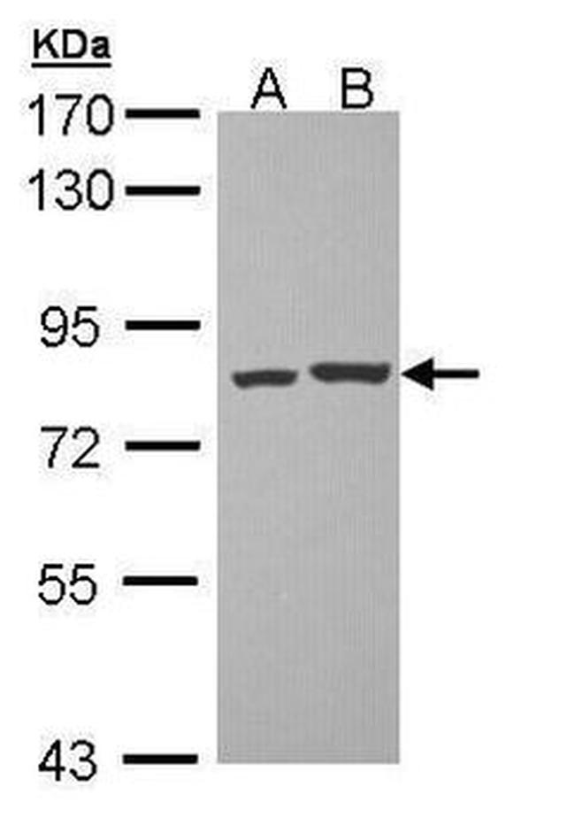 PKC theta Antibody in Western Blot (WB)