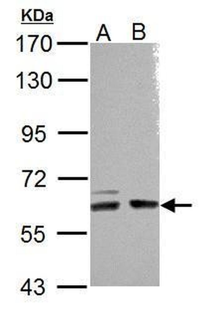 ARHGEF9 Antibody in Western Blot (WB)