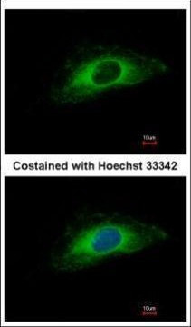 Cytokeratin 7 Antibody in Immunocytochemistry (ICC/IF)
