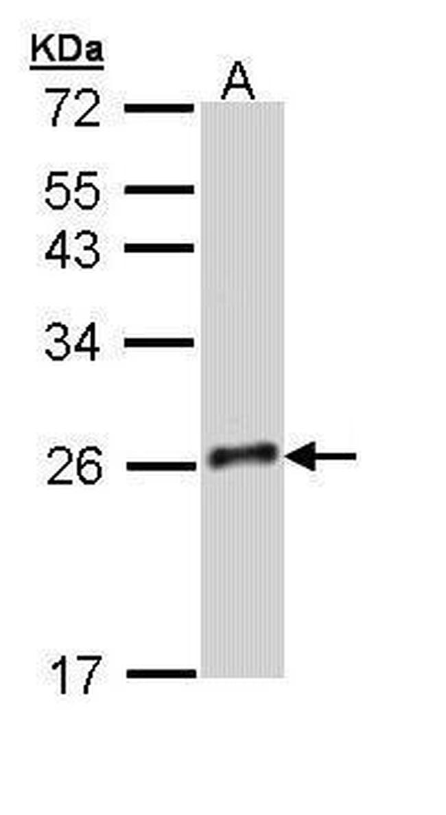 GH2 Antibody in Western Blot (WB)