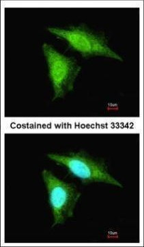 SMAD3 Antibody in Immunocytochemistry (ICC/IF)