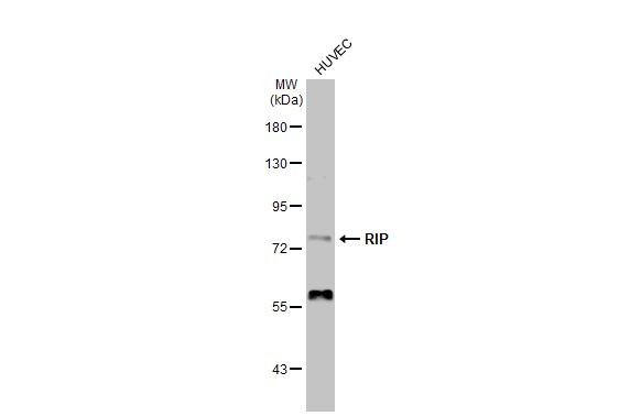 RIP1 Antibody in Western Blot (WB)