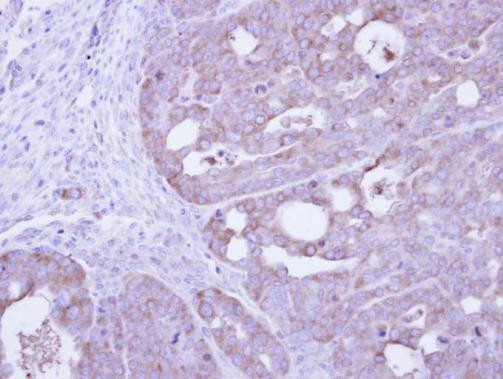 PKM2 Antibody in Immunohistochemistry (Paraffin) (IHC (P))