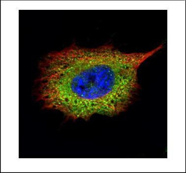 SQSTM1 Antibody in Immunocytochemistry (ICC/IF)