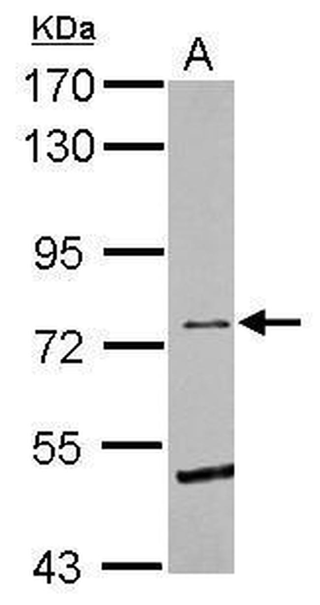 EphB6 Antibody in Western Blot (WB)