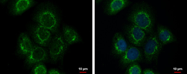 Fibulin 3 Antibody in Immunocytochemistry (ICC/IF)