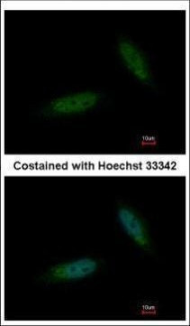 TBCK Antibody in Immunocytochemistry (ICC/IF)