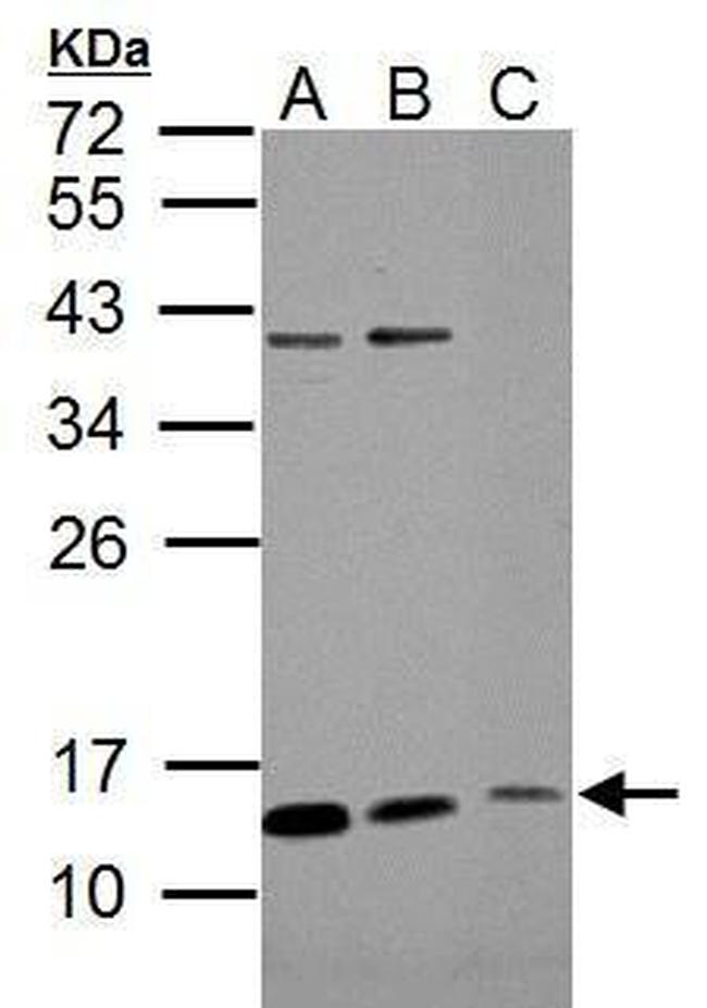 ROPN1B Antibody in Western Blot (WB)
