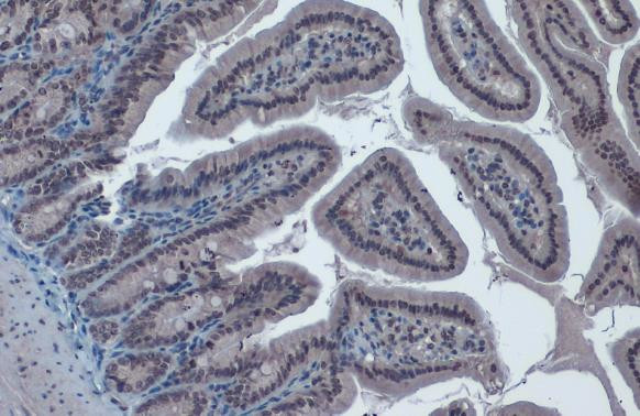 TIP60 Antibody in Immunohistochemistry (Paraffin) (IHC (P))