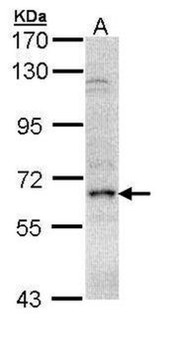 EIF2A Antibody in Western Blot (WB)