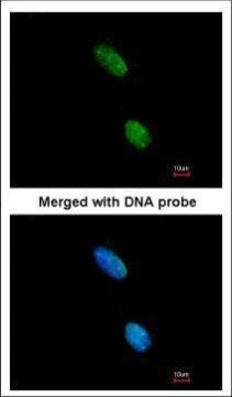 KIR3DL2 Antibody in Immunocytochemistry (ICC/IF)