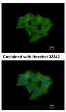 Annexin A4 Antibody in Immunocytochemistry (ICC/IF)