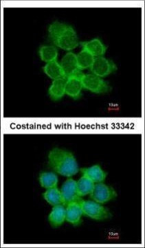 15-PGDH Antibody in Immunocytochemistry (ICC/IF)