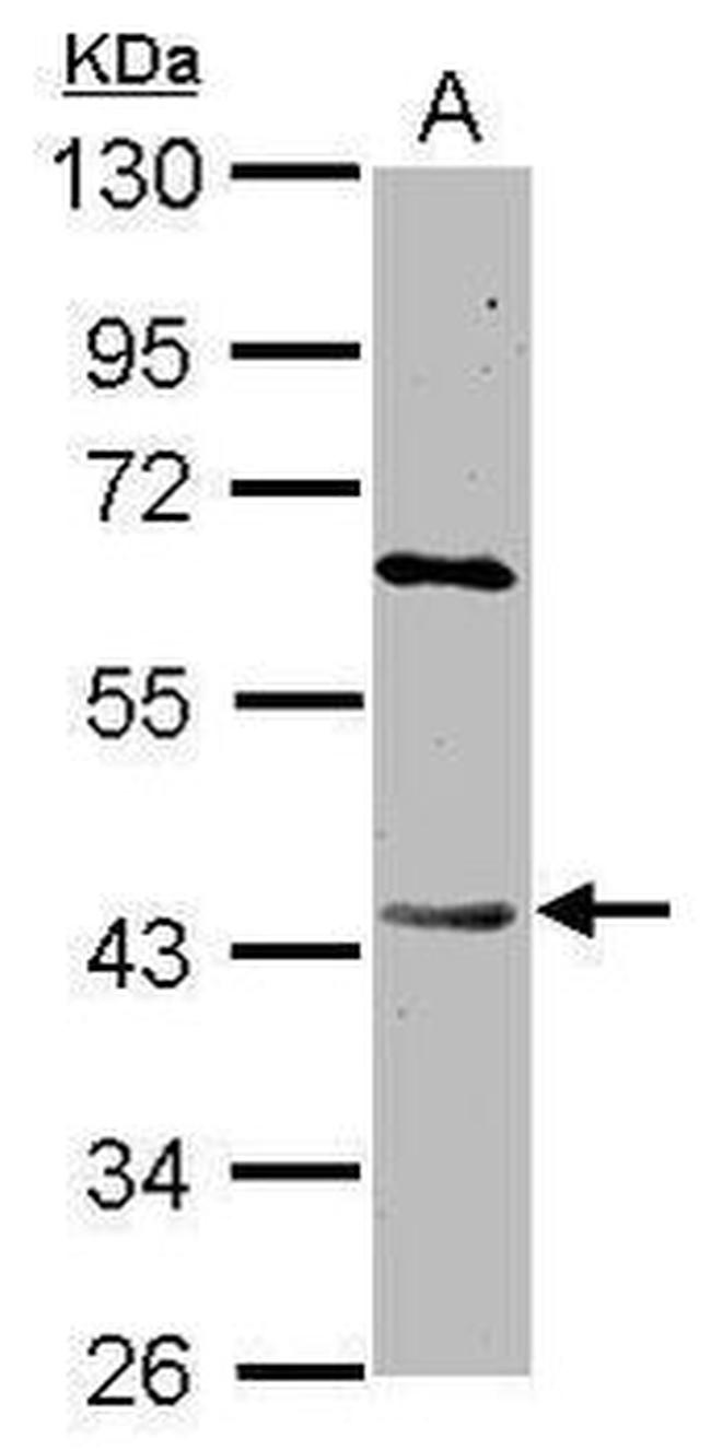 DAPK2 Antibody in Western Blot (WB)