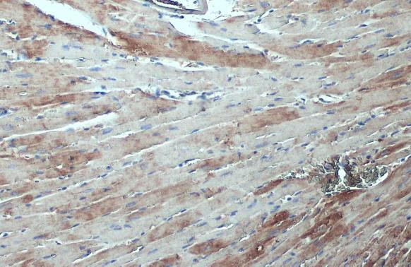 ASAH1 Antibody in Immunohistochemistry (Paraffin) (IHC (P))