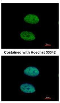 DDX3 Antibody in Immunocytochemistry (ICC/IF)