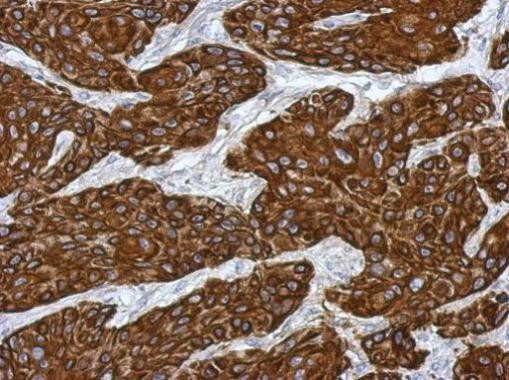 Cytokeratin 15 Antibody in Immunohistochemistry (Paraffin) (IHC (P))