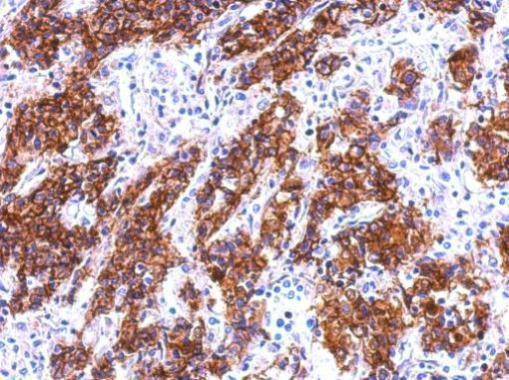 Galectin 4 Antibody in Immunohistochemistry (Paraffin) (IHC (P))