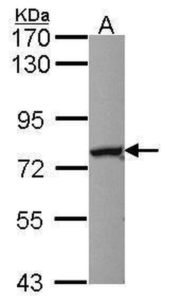 NFE2L1 Antibody in Western Blot (WB)