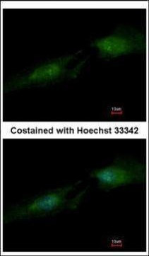 SMS Antibody in Immunocytochemistry (ICC/IF)