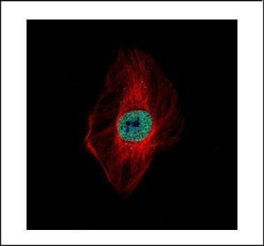 DDX23 Antibody in Immunocytochemistry (ICC/IF)