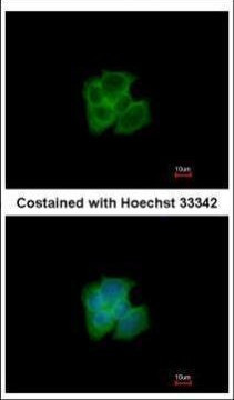 GAPDHS Antibody in Immunocytochemistry (ICC/IF)