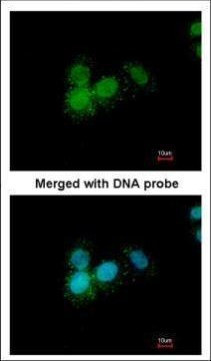 Progesterone Receptor Antibody in Immunocytochemistry (ICC/IF)