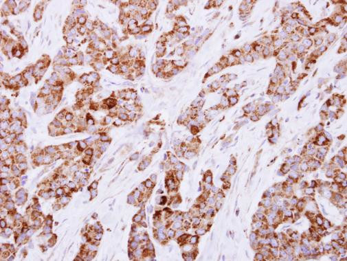 CESK1 Antibody in Immunohistochemistry (Paraffin) (IHC (P))