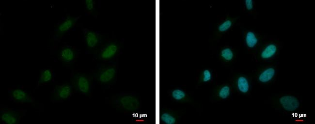 DEPDC1 Antibody in Immunocytochemistry (ICC/IF)