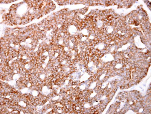 ARPC1A Antibody in Immunohistochemistry (Paraffin) (IHC (P))