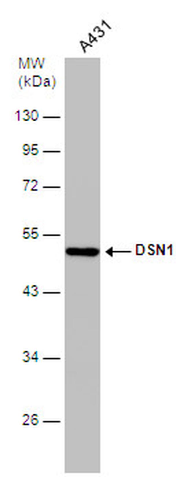 DSN1 Antibody in Western Blot (WB)