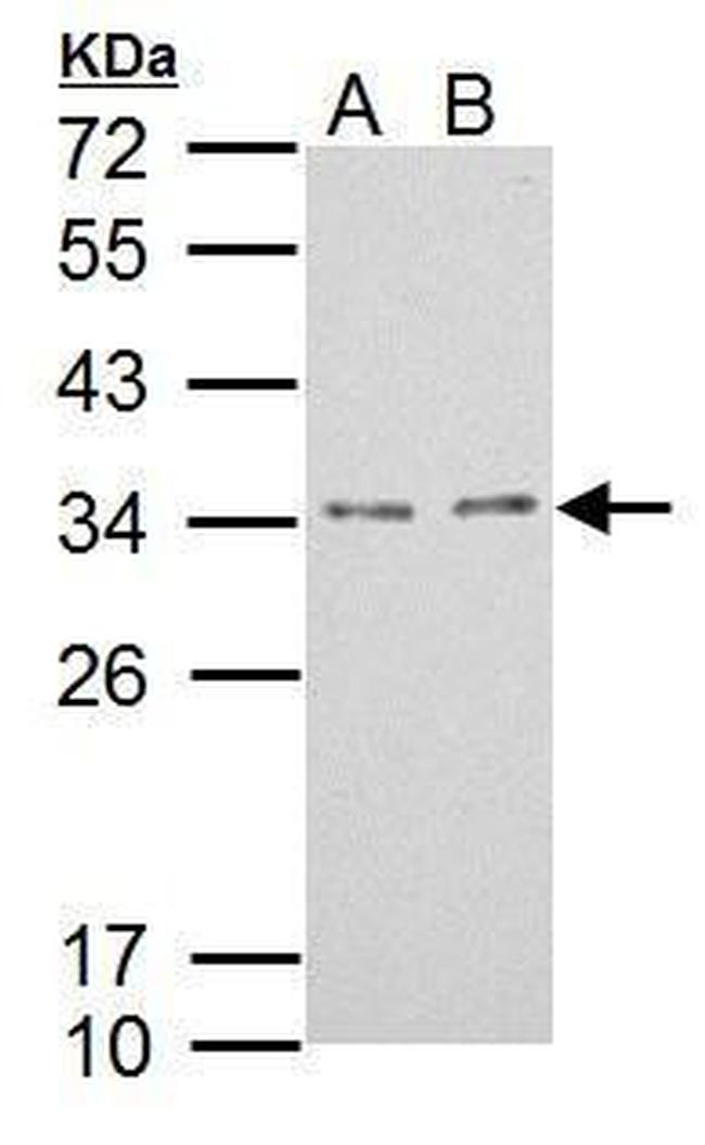 TPRG1L Antibody in Western Blot (WB)