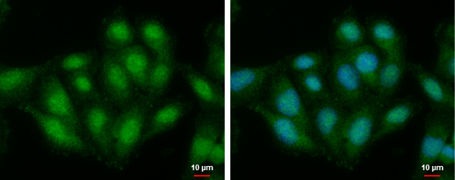 TRAK2 Antibody in Immunocytochemistry (ICC/IF)