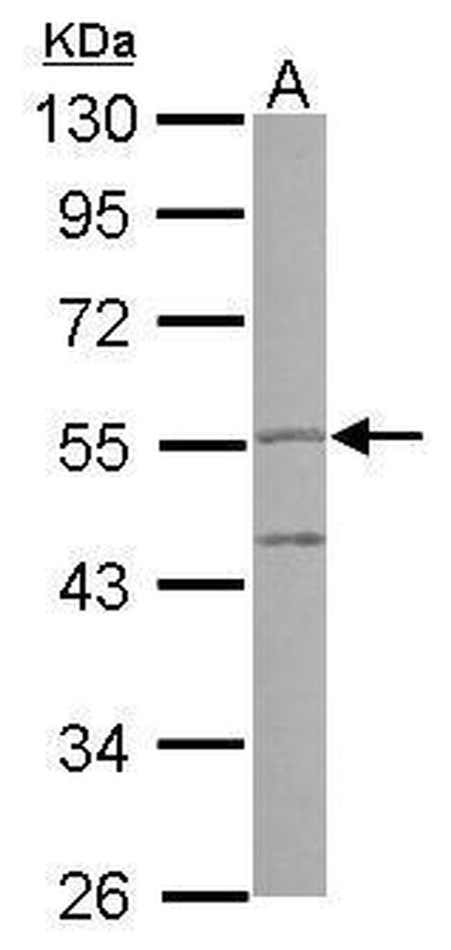 PI16 Antibody in Western Blot (WB)