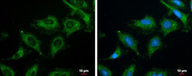Phospho-ROCK2 (Ser1366) Antibody in Immunocytochemistry (ICC/IF)
