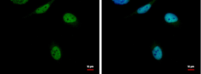 RED Antibody in Immunocytochemistry (ICC/IF)