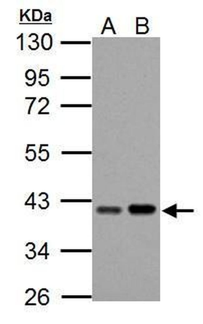 PECI Antibody in Western Blot (WB)