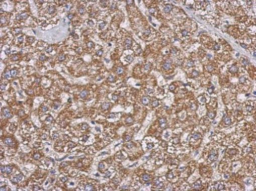 GBAS Antibody in Immunohistochemistry (Paraffin) (IHC (P))