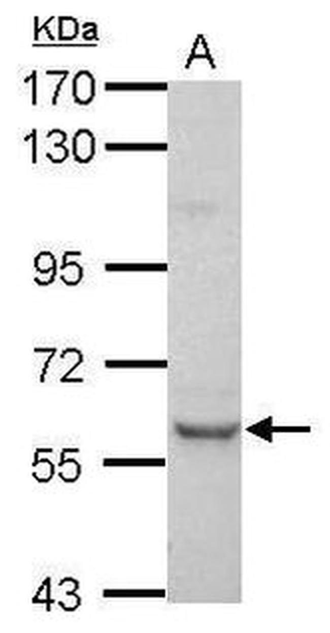 PLAG1 Antibody in Western Blot (WB)