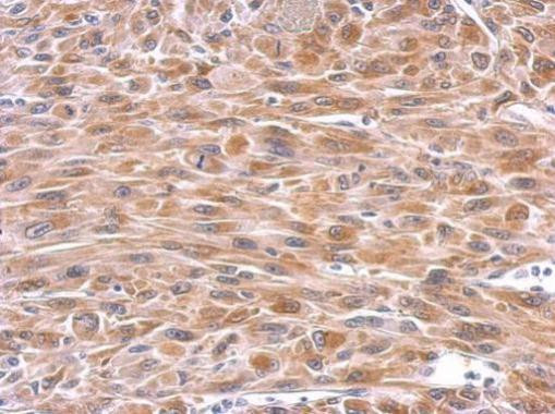 GPX8 Antibody in Immunohistochemistry (Paraffin) (IHC (P))