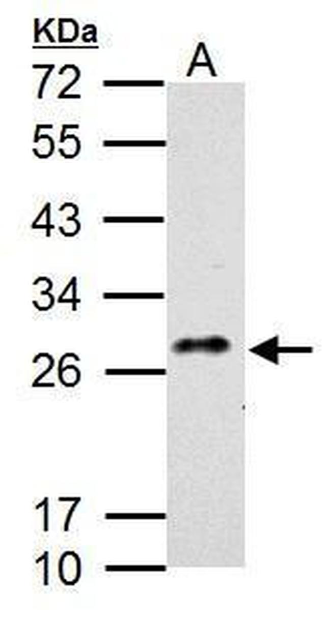 CLEC5A Antibody in Western Blot (WB)