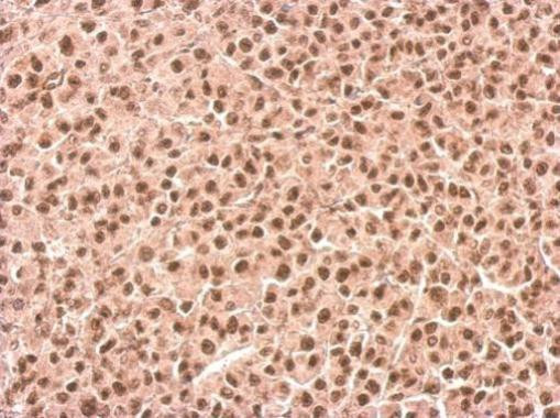 SETD2 Antibody in Immunohistochemistry (Paraffin) (IHC (P))