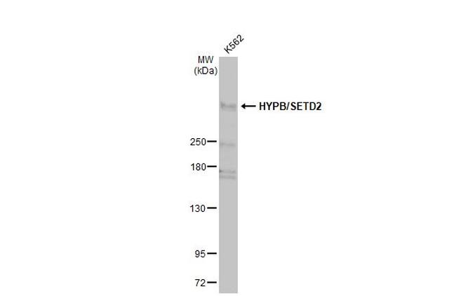 SETD2 Antibody in Western Blot (WB)