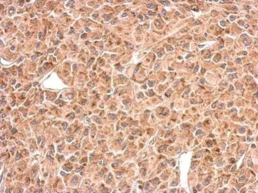 C9orf72 Antibody in Immunohistochemistry (Paraffin) (IHC (P))