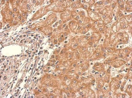 PAK6 Antibody in Immunohistochemistry (Paraffin) (IHC (P))