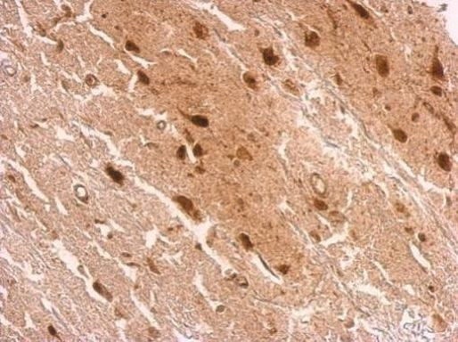 HOXD8 Antibody in Immunohistochemistry (Paraffin) (IHC (P))
