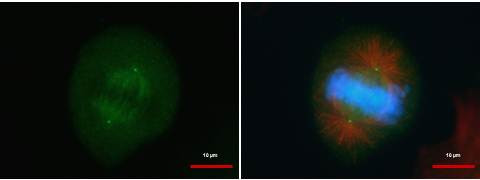 CEP152 Antibody in Immunocytochemistry (ICC/IF)