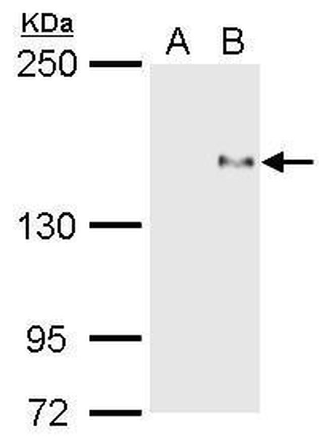 PREX1 Antibody in Western Blot (WB)