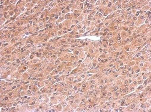 PREX1 Antibody in Immunohistochemistry (Paraffin) (IHC (P))